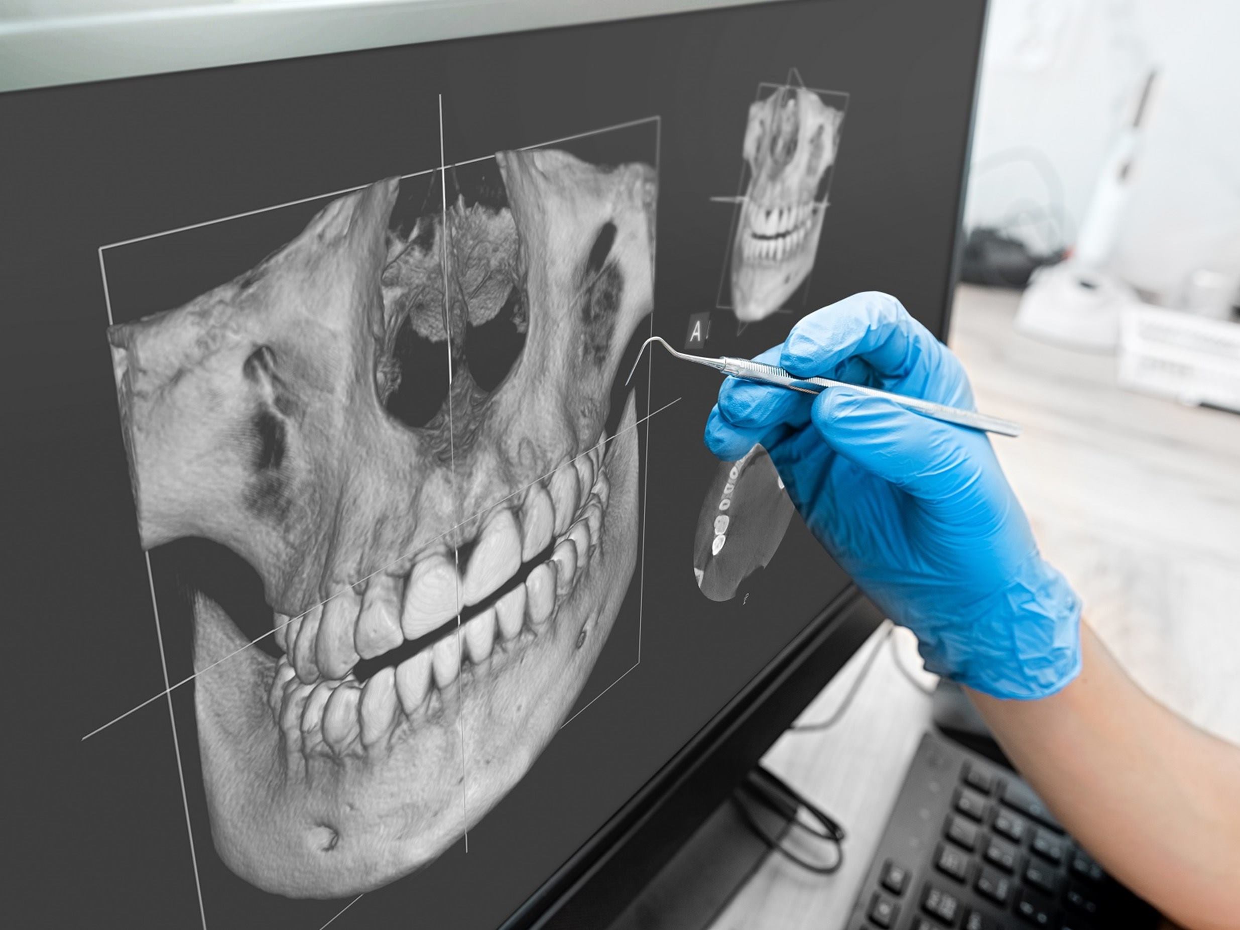 odontologia_tratamiento_dientes-radiografia_revision